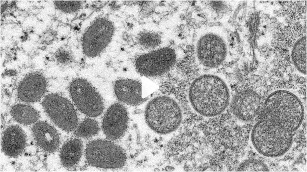 Monkeypox virus under microscope