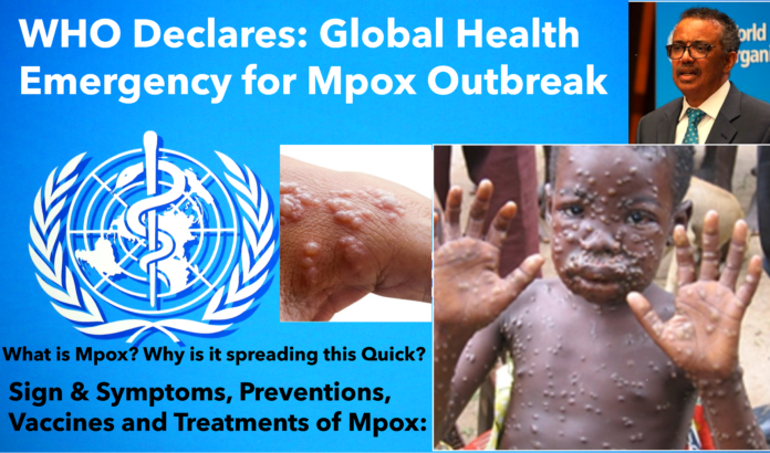 Monkeypox